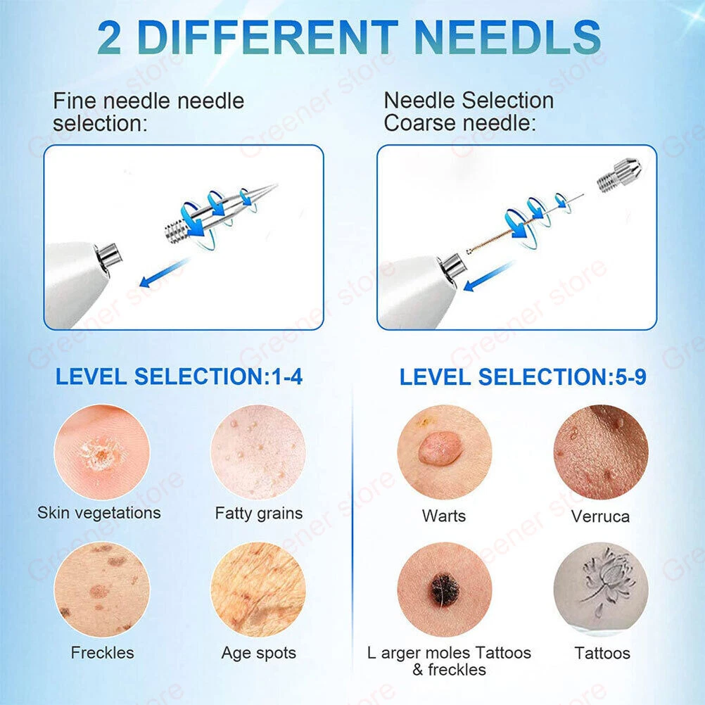 Laser LCD Skin Treatment Pen – Mole, Skin Tag, Age Spot & Freckle Removal Device