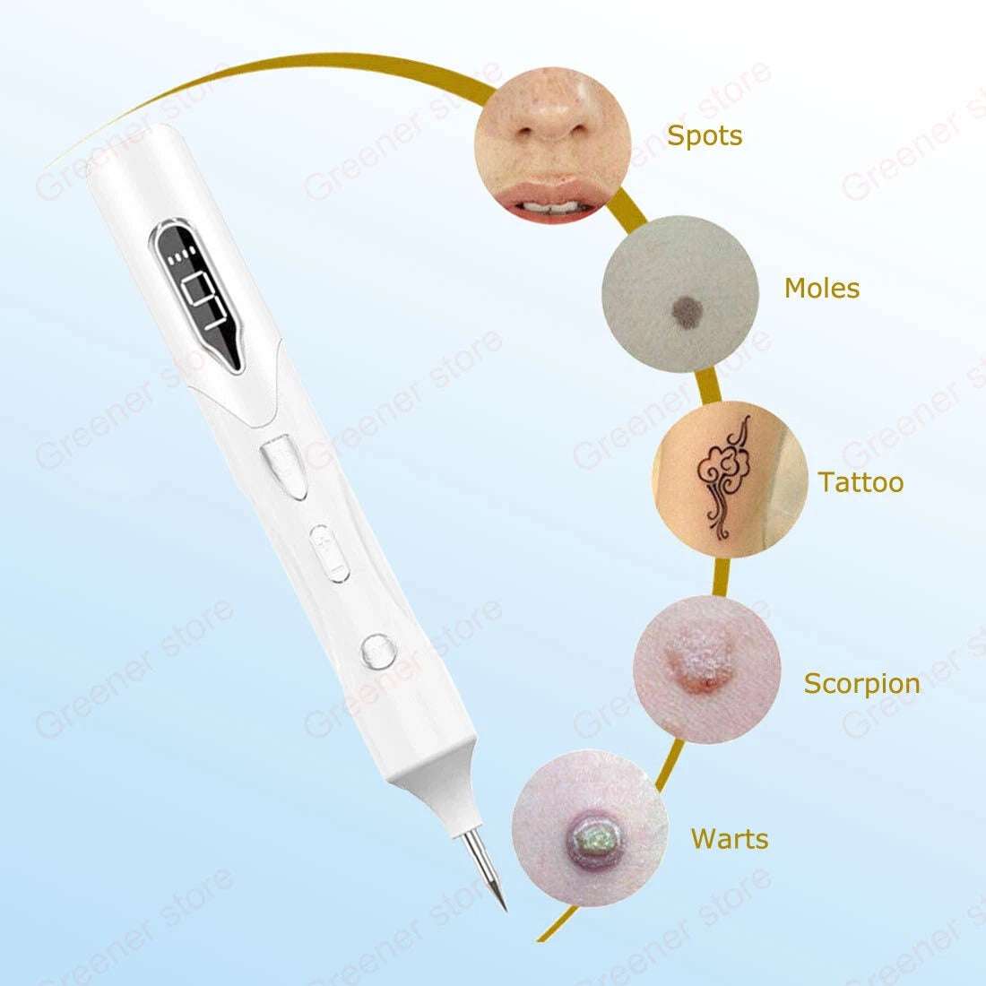 Laser LCD Skin Treatment Pen – Mole, Skin Tag, Age Spot & Freckle Removal Device