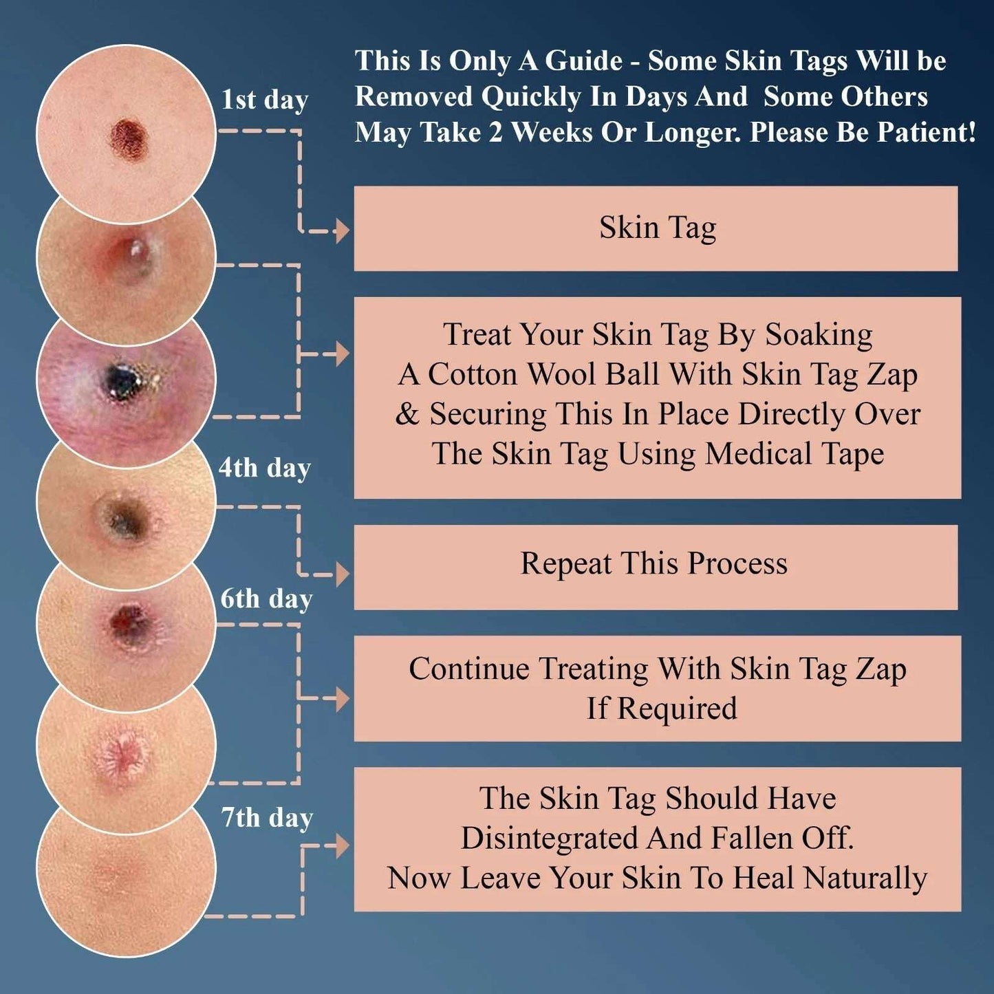 Skin Tag Remover Treatment – Safe Home Remedy Formula, Made in the UK