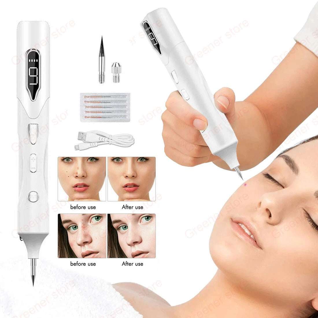 Laser LCD Skin Treatment Pen – Mole, Skin Tag, Age Spot & Freckle Removal Device